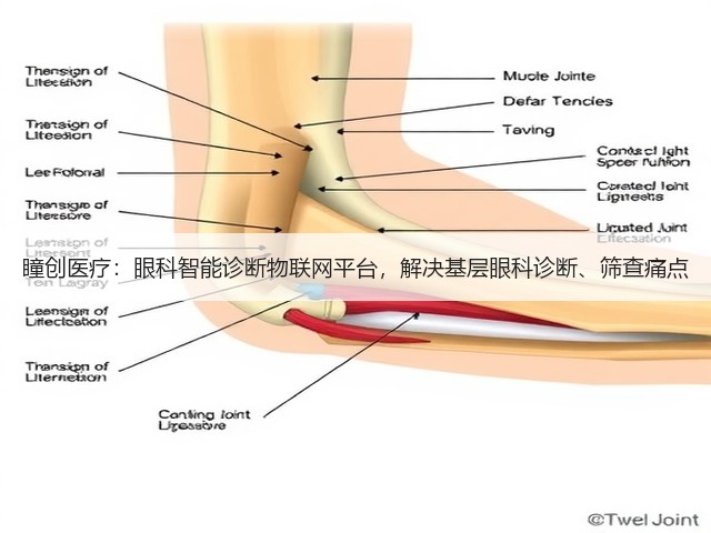 瞳创医疗：眼科智能诊断物联网平台，解决基层眼科诊断、筛查痛点(图3)