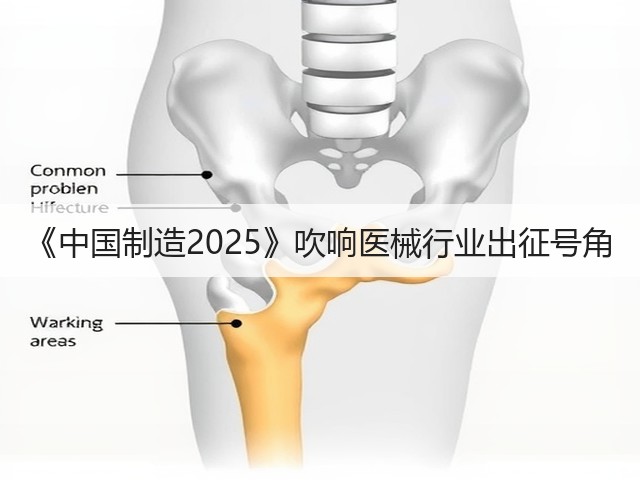 《中国制造2025》吹响医械行业出征号角(图3)